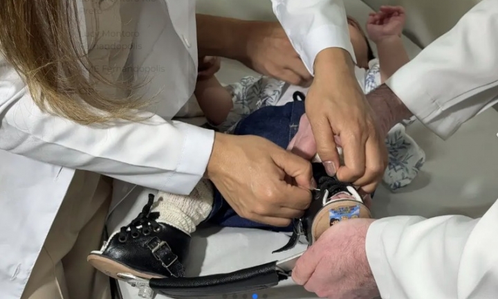 Palestra sobre Pé Torto Congênito ocorre no Ambulatório da Santa Casa