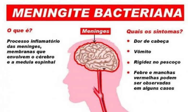 Prefeitura de Avaré confirma morte de bebê por meningite