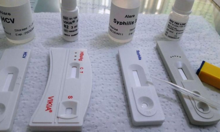 Postos de saúde oferecem testes rápidos de HIV, sífilis e hepatites virais