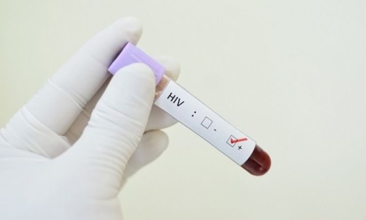 Fique Sabendo: Saúde vai iniciar campanha de testagem de HIV