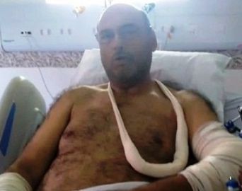 Poio Novaes sofre queda de bicicleta e passa por cirurgias